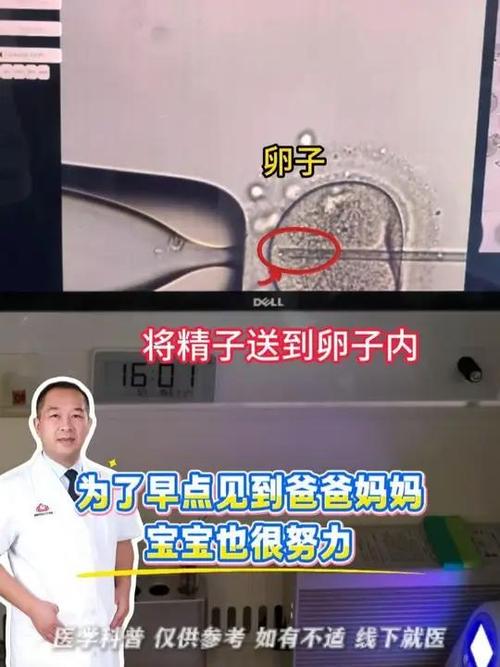 二代试管原理详解 卵胞浆内单精子注射如何助孕