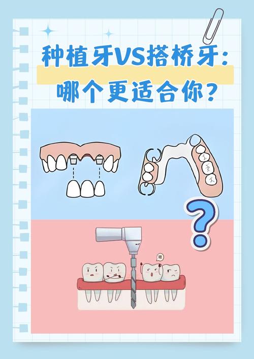 哪家种牙好_牙种好后还会出现什么问题_牙种好后能随便吃东西吗