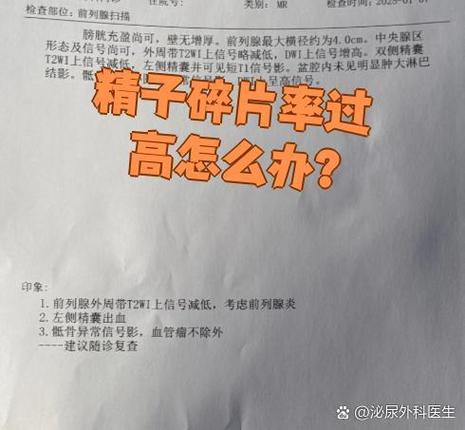 精子DNA碎片率高怎么办 影响生育吗