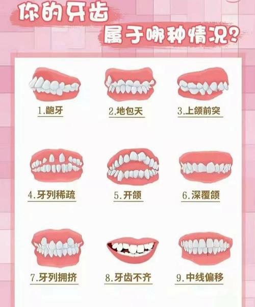 40多岁还可以做牙齿矫正吗_牙齿矫正做可以吃饭吗_牙齿矫正做可以用医保吗