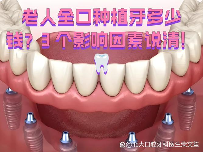 鄂尔多斯老年种植牙 全口费用参考_老年无牙菜谱100例_鄂尔多斯种植蒙icp备