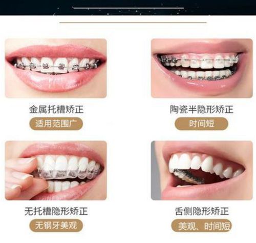 牙齿校正要多长时间_30岁能校正牙齿吗_牙齿校正能报销吗