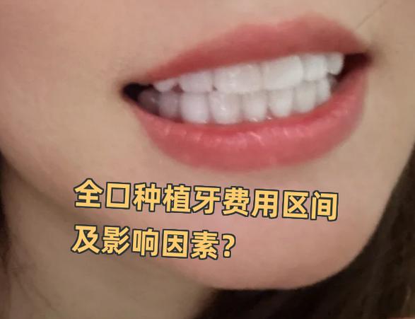 罗湖医院种一颗牙要多少钱_深圳罗湖骨量不足全口种牙费用_罗湖种牙哪里最好
