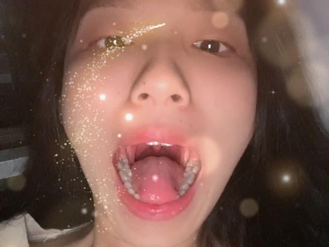 口腔检查第一视角真的有用吗？