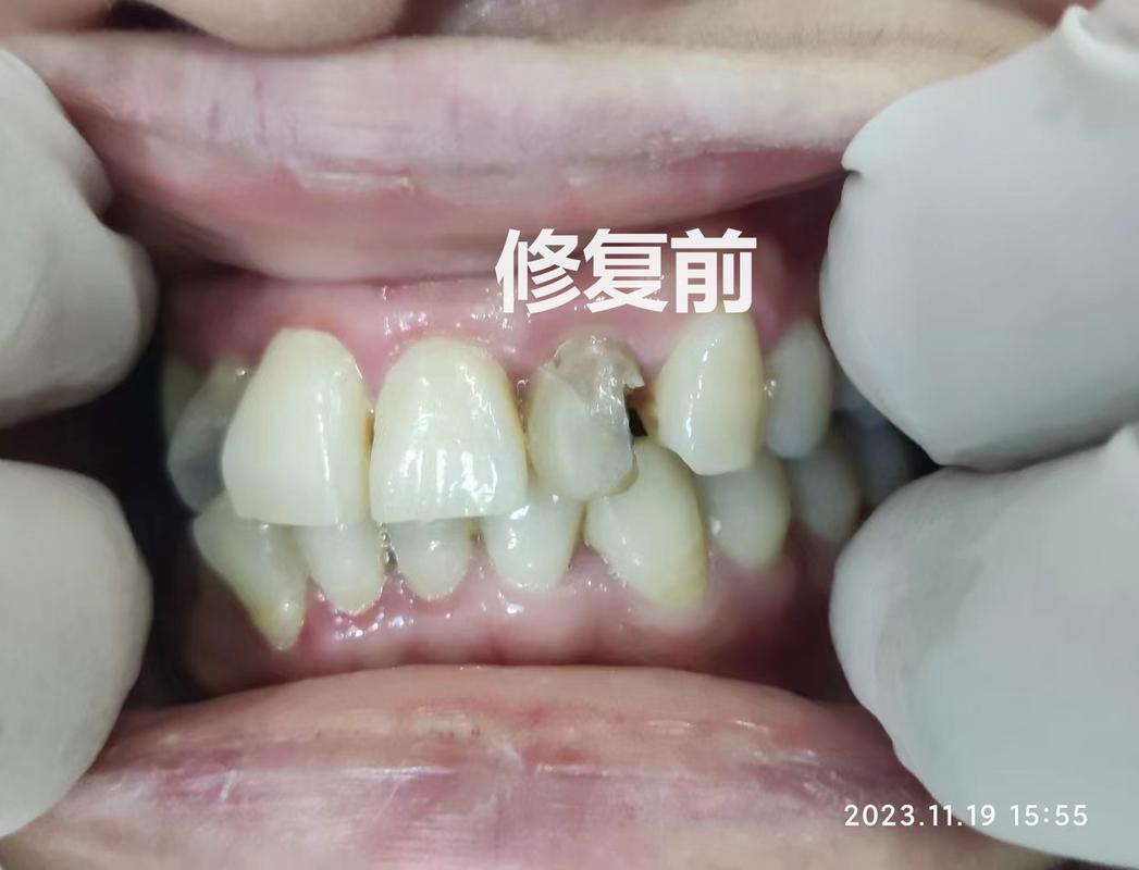 口腔诊疗服务怎么挑不踩坑？看牙前你最好先把这几条搞明白