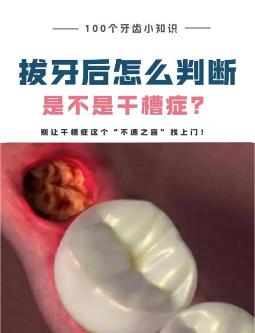 大牙拔掉后不种植会怎么样_种植牙拔掉后有过渡牙吗_拔大牙后种牙