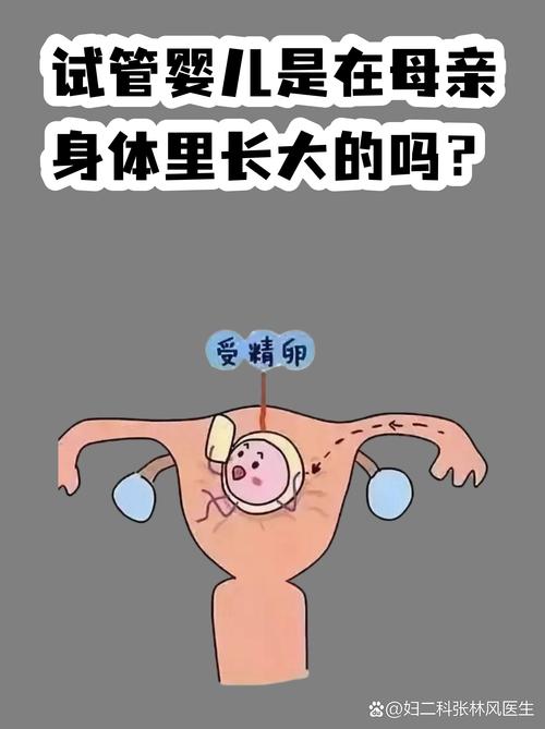 什么叫婴儿试管_试管婴儿常见误区有哪些_误区婴儿常见试管有几种