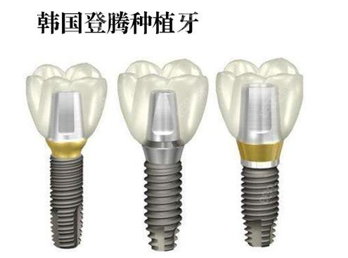 株洲种植牙好的牙科医院排名_株洲种植牙医院推荐 性价比公立_株洲牙科医院哪家最好的医院