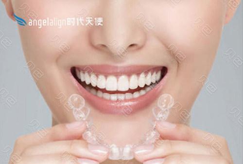 成人牙缝矫正大概要花费多少钱_牙齿矫正深圳_深圳成年人牙缝大矫正方案
