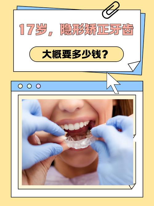 隐形的矫正牙齿_隐形牙齿矫正知乎_德韩隐形矫正牙齿