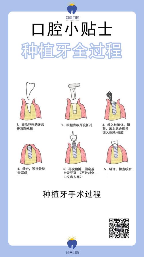 种植门牙期间要一直空缺吗_门牙掉了怎么种植_门牙种植期间空着很难看怎么办