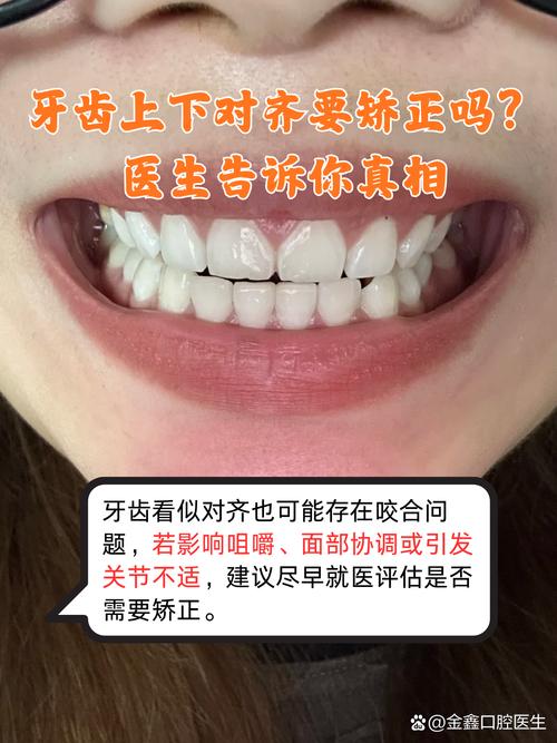 成人牙齿矫正一般多少钱_成人矫正牙齿口腔_成人牙齿矫正流程