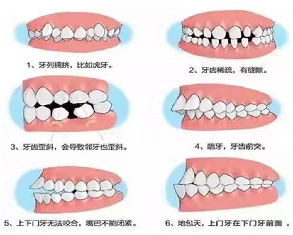 成人门牙不齐能矫正吗_牙齿矫正成人可以吗_成人矫正牙齿会松动吗