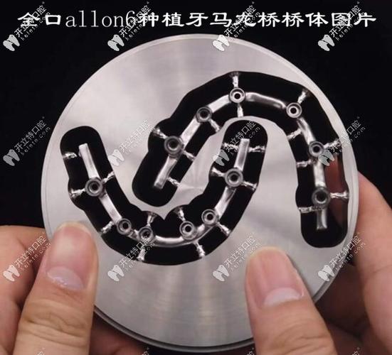 深圳市种植牙医院_深圳半口all-on4种植牙医院地址_深圳种植牙齿最好的医院
