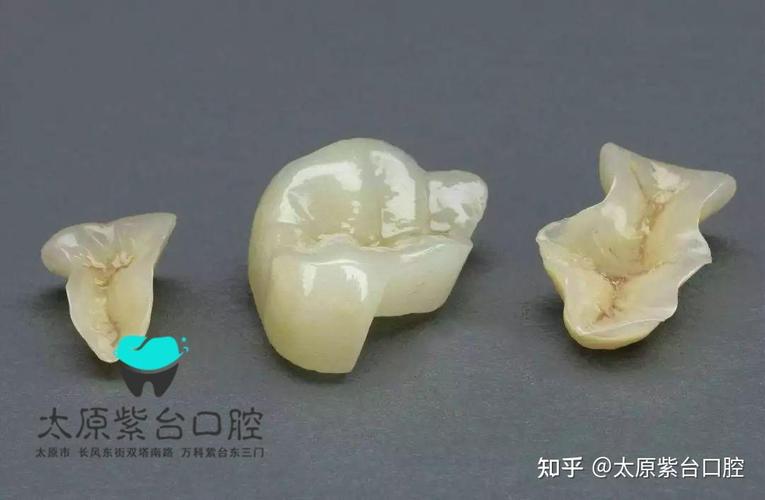 口腔检查反馈单看不懂?3步教你秒读