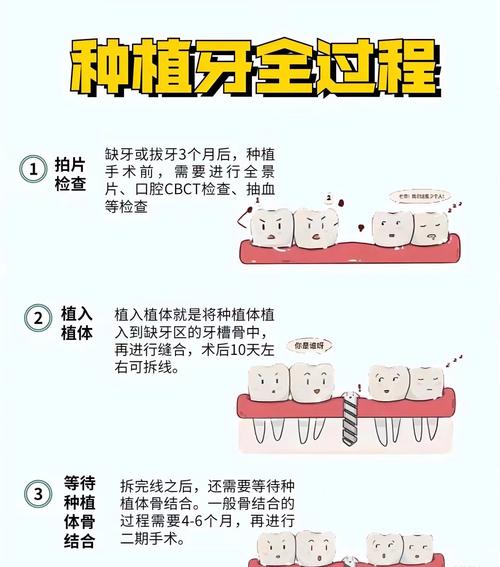 甘露园种牙的诊所_济南牙诊所_中日医院的种牙保