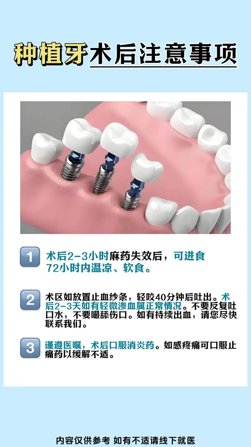 牙种植好不好_牙种植的危害_安种植牙的利弊