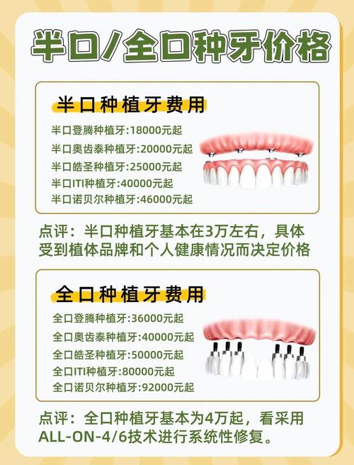 上海种植牙优惠活动_上海种牙满口多少钱_上海半口全口种植牙费用 2026 集采