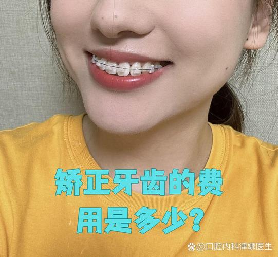 纠正牙型要多少钱_纠正牙型前期准备什么_纠正牙型有危害吗