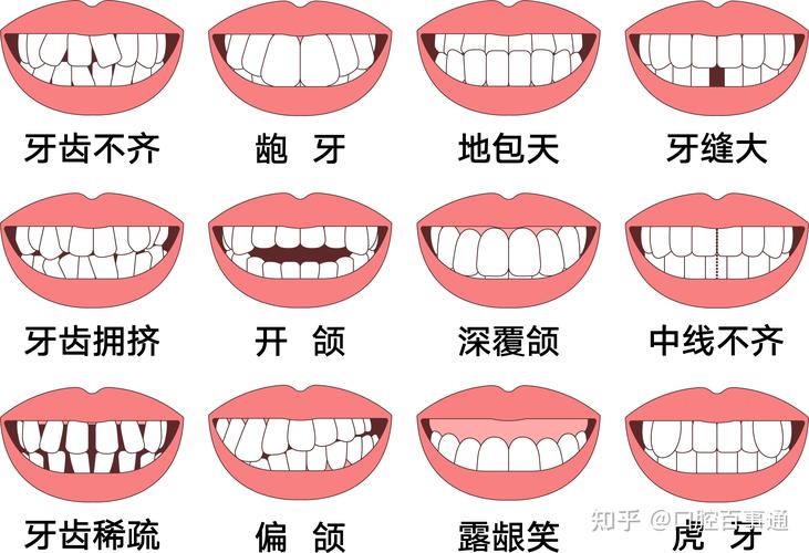 25岁去矫正牙齿_牙齿矫正去医院还是口腔机构_25岁去矫正牙齿