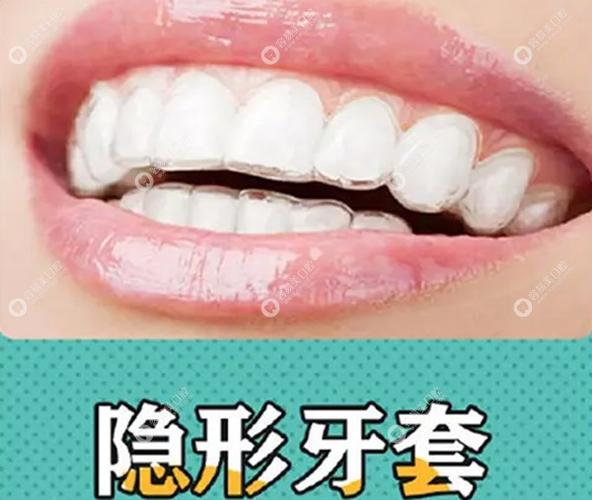 深圳隐适美矫正价格_深圳隐形牙套矫正价格_深圳龙岗隐适美牙套收费