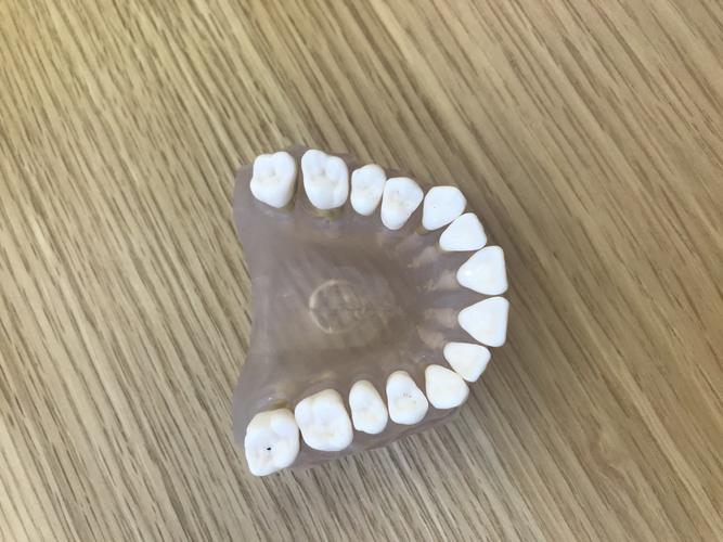 nobel种牙怎么样_nobel种植牙特点_种牙nobelactive