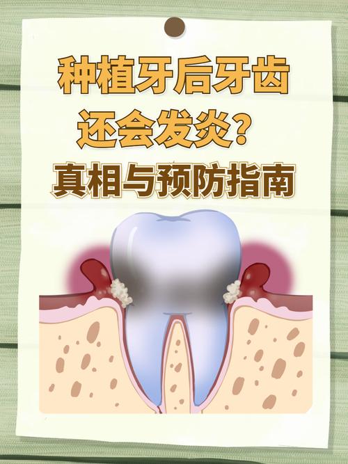 拔牙种植牙医保可以报销吗_拔牙种植牙需要多久时间_拔种植牙吗