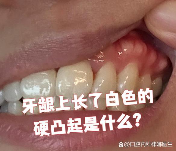 缺一颗牙一定要种吗 不种的后果你承受得起吗