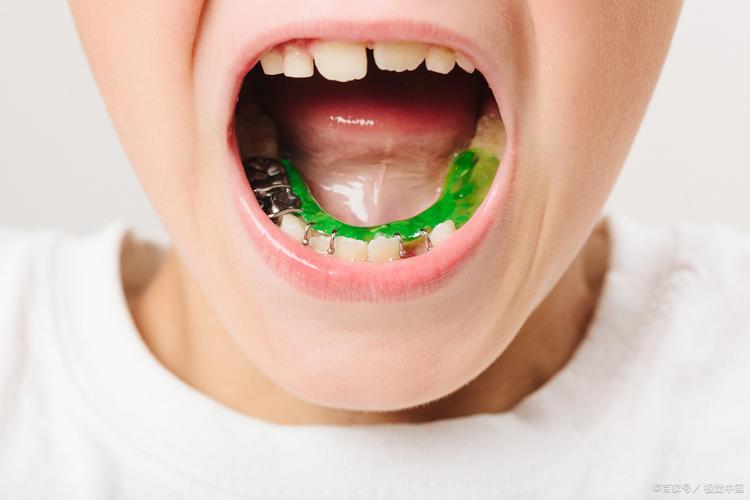 六岁孩子门牙长歪了怎么矫正_长歪的门牙_孩子门牙长歪了矫正多少钱
