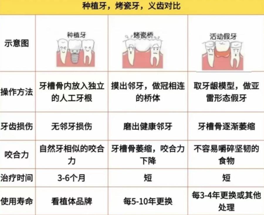 2万块的植牙够吗_德贝植牙_唇腭裂牙糟骨植骨图片