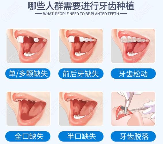 保定口腔医院收费多少钱?看牙项目全解析