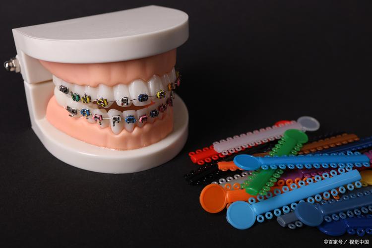 牙齿矫正做手术费用_牙齿矫正花费手术要多久_矫正牙齿手术要多少花费