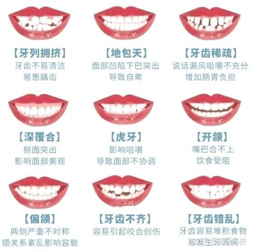 牙齿矫正做手术费用_矫正牙齿手术要多少花费_牙齿矫正花费手术要多久