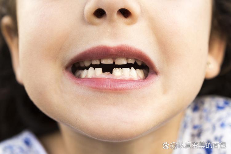 8岁孩子牙齿矫正用什么方法_小孩牙齿矫正器怎么戴_孩子牙齿矫正用什么好