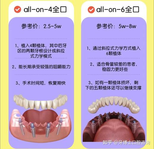 牙种植体价格_种植一颗牙_牙种植体哪个牌子好