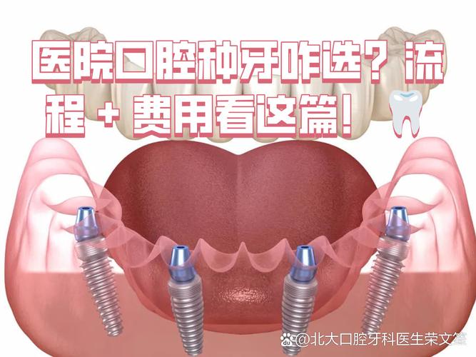 深圳种植最好的口腔牙科诊所_深圳种牙_深圳连锁牙科种牙划算吗