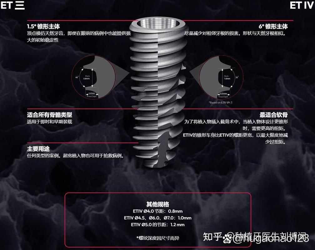 皓圣种植牙一般能用多少年_深圳皓圣种植牙医院推荐_皓圣美牙科种植体价格