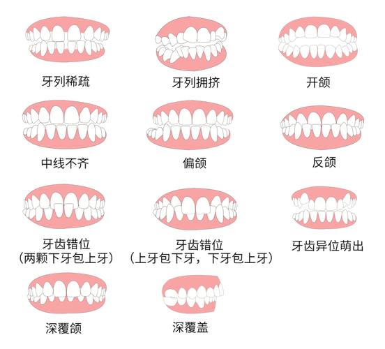 30岁牙齿矫正的利与弊_牙齿矫正利大于弊吗_牙齿矫正弊利有哪些