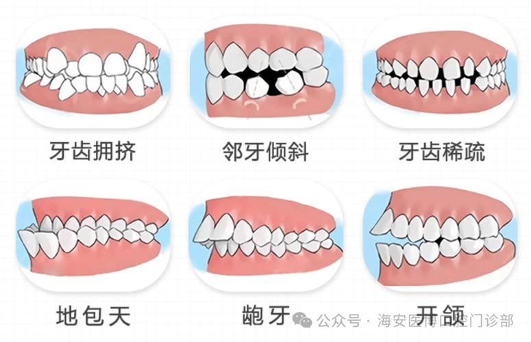 30岁牙齿矫正的利与弊_牙齿矫正利大于弊吗_牙齿矫正弊利有哪些