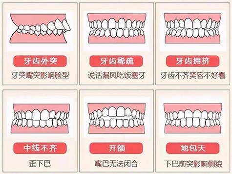 医院种牙收费标准_现在医院种一颗牙多少钱_医院种牙贵吗