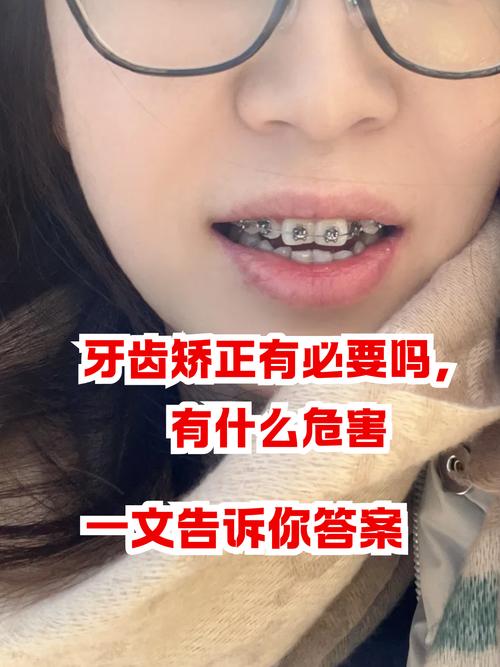 13岁牙齿矫正的后遗症有哪些_牙齿矫正有后遗症没_牙齿矫正后遗症有多可怕