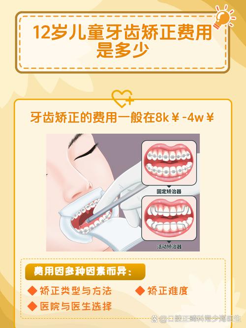 12岁做牙齿矫正多少钱_牙齿矫正的钱是一次付清吗_牙齿矫正钱