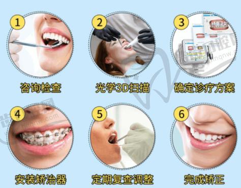 种植牙安卓健的品种_安卓健种植牙11000贵吗_安卓健种植一颗牙一般多少钱