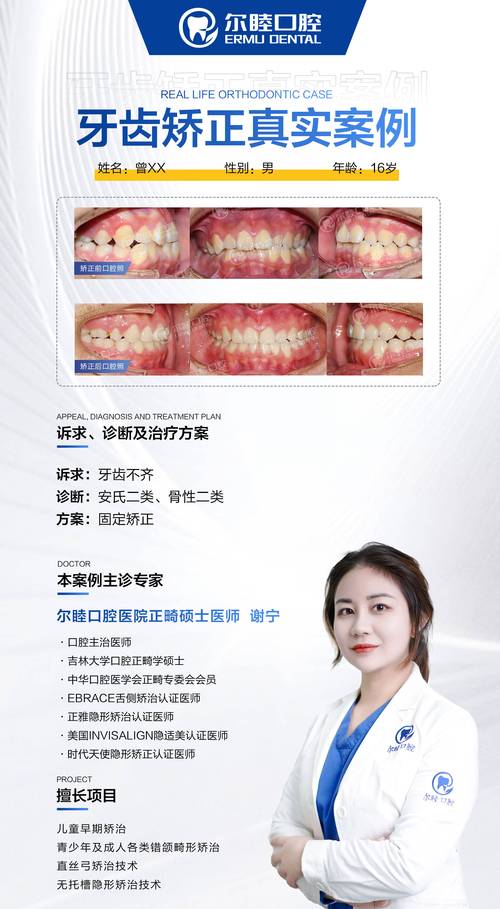 隐形牙齿矫正器哪种好_隐形牙齿矫正牌子_隐形牙齿矫正品牌排行榜