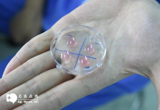 天津试管婴儿费用 单周期参考_天津试管价格明细表_天津试管的流程