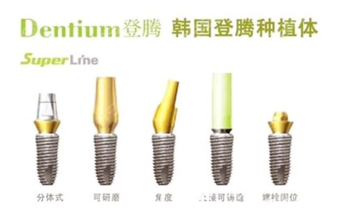 韩国登腾种植牙使用寿命_韩国登腾种植体牙一颗多少钱_韩国登腾种植牙使用了五年了