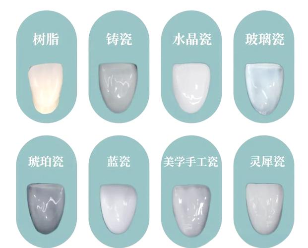 牙齿种贴面好还是种植_贴面牙齿价格_哪种牙齿贴面好