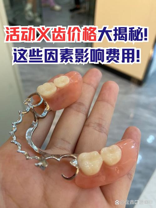 种牙假牙是连在一起的吗_固定假牙种牙_活动假牙固定假牙种植牙哪个好