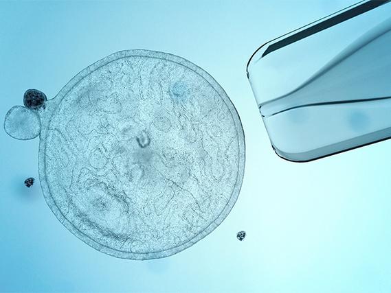 上海婴儿试管攻略_上海试管婴儿费用_上海试管婴儿费用 2026 8-15 万参考