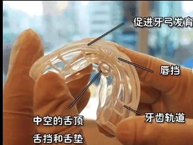 深圳南山矫正牙齿哪家好_深圳隐形矫正多少钱_深圳南山儿童隐形MRC矫正费用